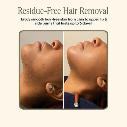 Facial Hair Removal Cream & Calming Serum