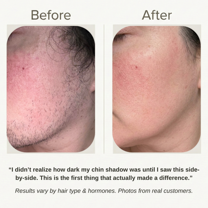 Velver — Hair Removal Cream for Menopause Chin & Upper-Lip Hair (45+)