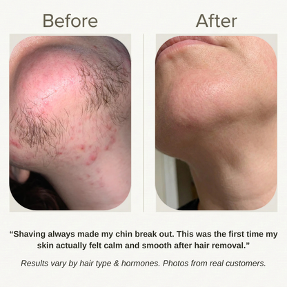 Velver — Hair Removal Cream for Menopause Chin & Upper-Lip Hair (45+)