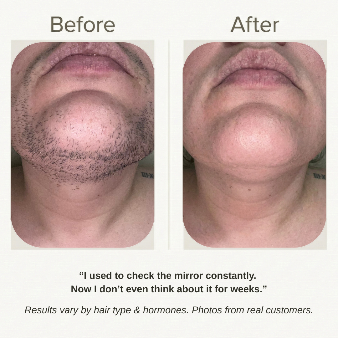 Velver — Hair Removal Cream for Menopause Chin & Upper-Lip Hair (45+)