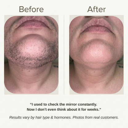 Velver — Hair Removal Cream for Menopause Chin & Upper-Lip Hair (45+)